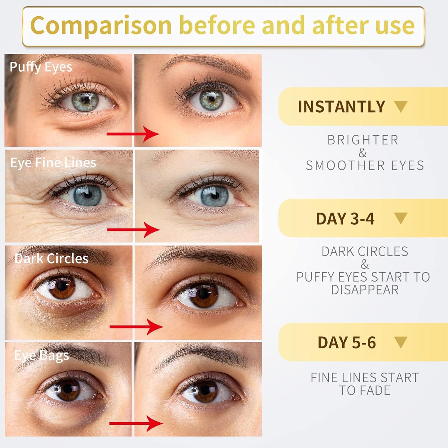 Under Eye Patches - 60 Pcs - 24K Gold Eye Mask- Puffy Eyes & Dark Circles Treatments,Reduce under Eye Bags and Smooth Wrinkles,Eye Skin Care Pads with Collagen,Hyaluronic Acid & Castor Oil