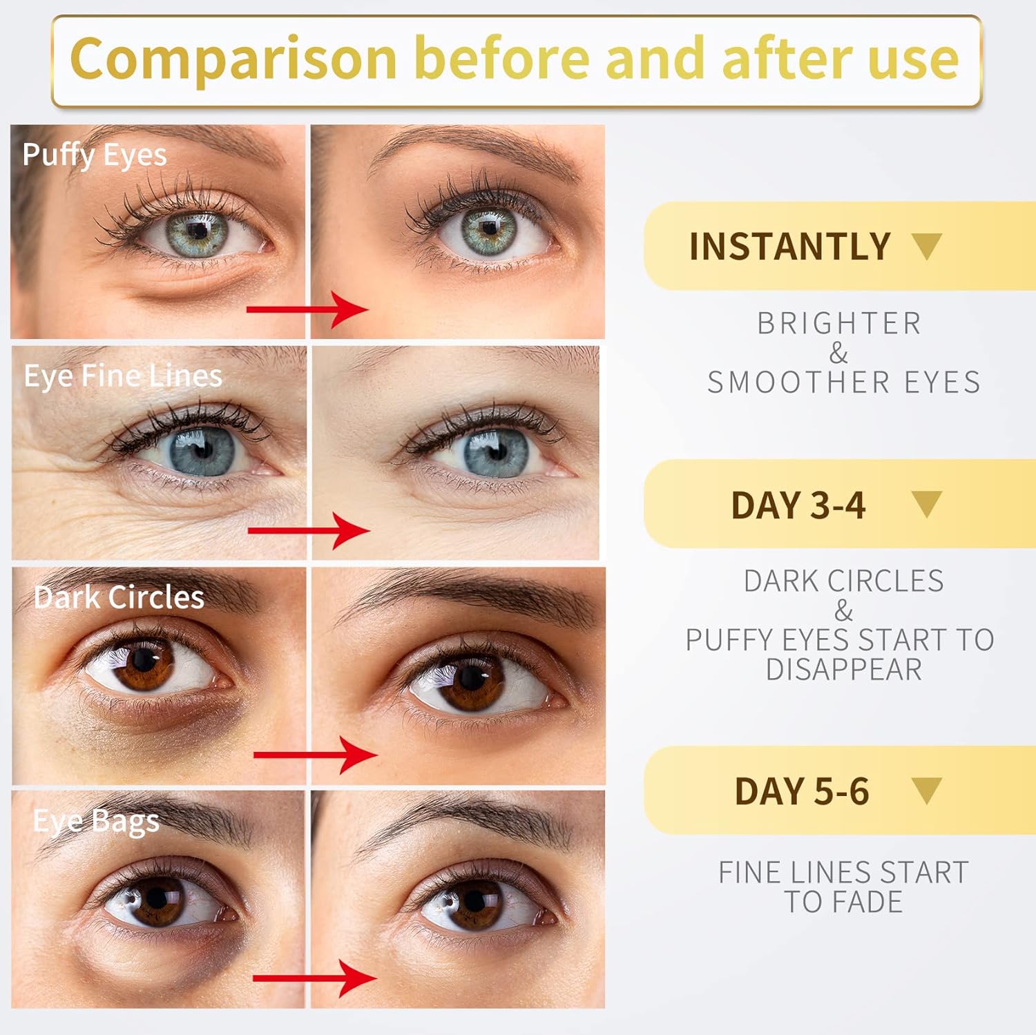 Under Eye Patches - 60 Pcs - 24K Gold Eye Mask- Puffy Eyes & Dark Circles Treatments,Reduce under Eye Bags and Smooth Wrinkles,Eye Skin Care Pads with Collagen,Hyaluronic Acid & Castor Oil
